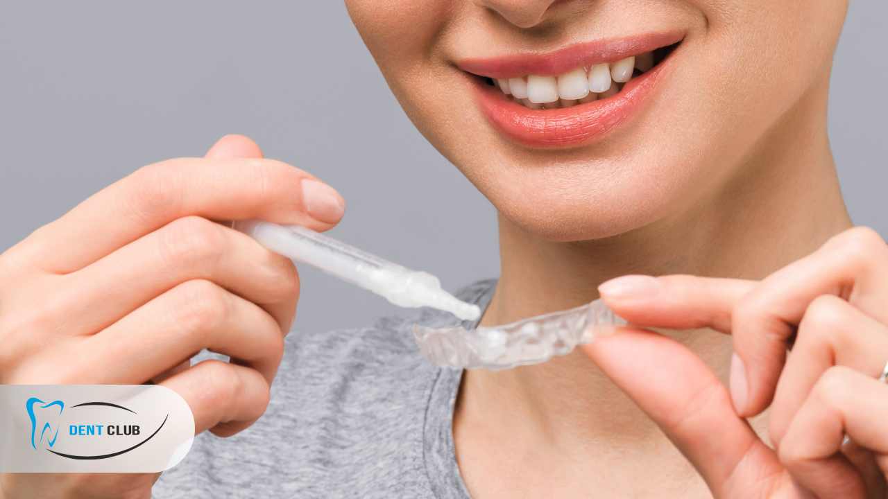 Do Teeth Whitening Kits Really Work