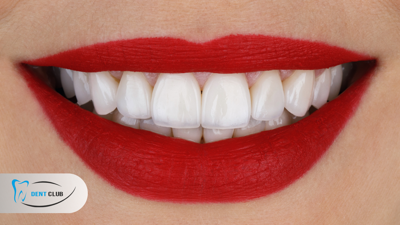 Hollywood Smile İşlemden Neler Beklemelisiniz